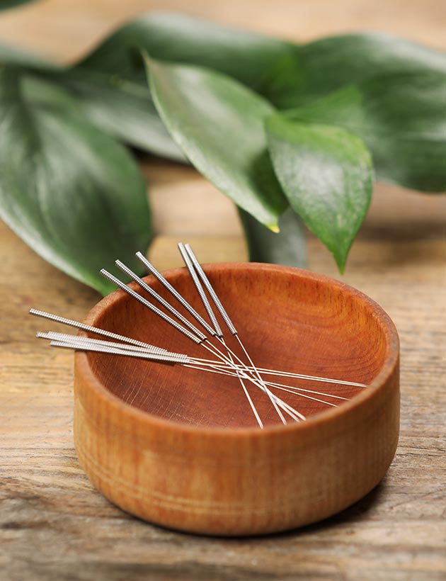 acupuncture-needles